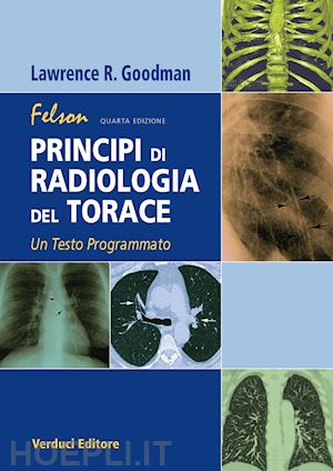 goodman lawrence r. - felson principi di radiologia del torace