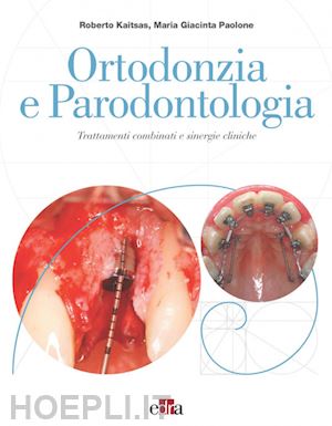 kaitsas r.; paolone m. g. - ortodonzia e parodontologia