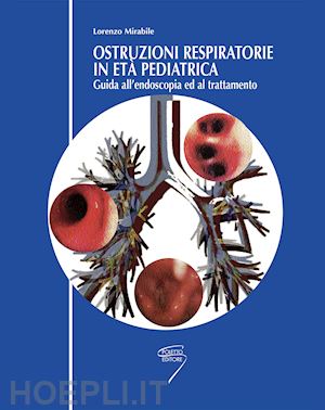 mirabile lorenzo - ostruzioni respiratorie in pediatria. guida all'endoscopia ed al trattamento
