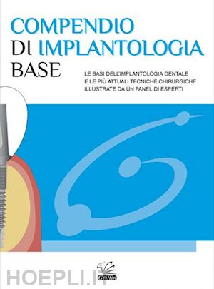 russo andrea - compendio di implantologia base