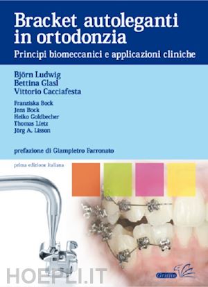 ludwing bjorn; glasl bettina; cacciafesta vittorio - bracket autoleganti in ortodonzia. principi biomeccanici e applicazioni cliniche