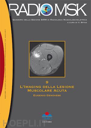 genovese eugenio - l'imaging della lesione muscolare acuta