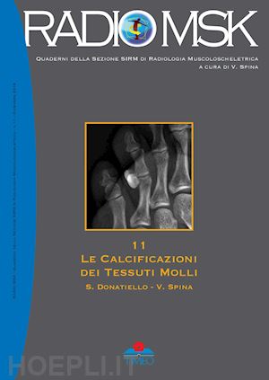 donatiello salvatore; spina vincenzo - le calcificazioni dei tessuti molli. ediz. illustrata