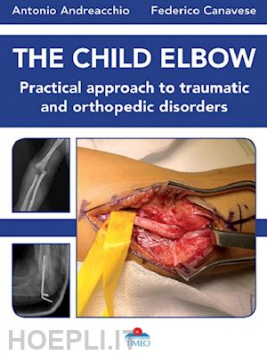 andreacchio antonio; canavese federico; villa r. (curatore) - the child elbow. practical approach to traumatic and orthopedic disorders