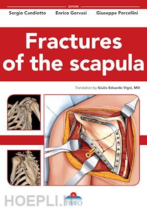 candiotto sergio; gervasi enrico; porcellini giuseppe; villa r. (curatore) - fractures of the scapula. ediz. illustrata