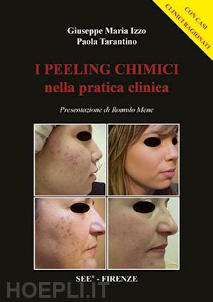 izzo giuseppe m.; tarantino paola - peeling chimici