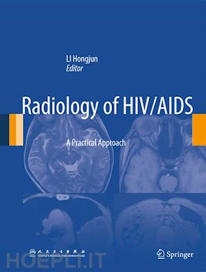 li hongjun (curatore) - radiology of hiv/aids