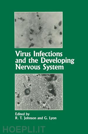 johnson r.t. (curatore); lyon g. (curatore) - virus infections and the developing nervous system