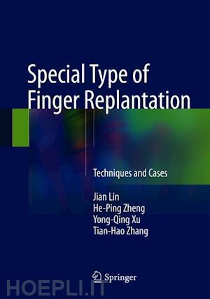 lin jian; zheng he-ping; xu yong-qing; zhang tian-hao - special type of finger replantation