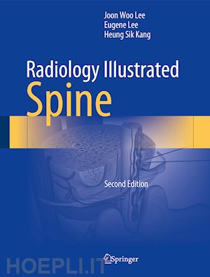 lee joon woo; lee eugene; kang heung sik - radiology illustrated: spine