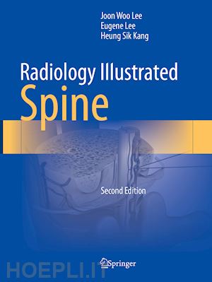 lee joon woo; lee eugene; kang heung sik - radiology illustrated: spine