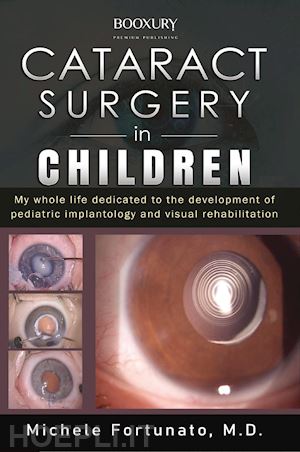 fortunato michele - cataract surgery in children