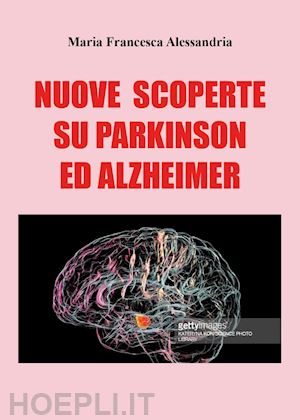 alessandria maria francesca - nuove scoperte sul parkinson e alzheimer