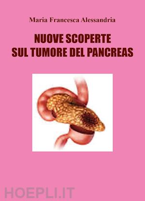 alessandria maria francesca - nuove scoperte sul tumore del pancreas