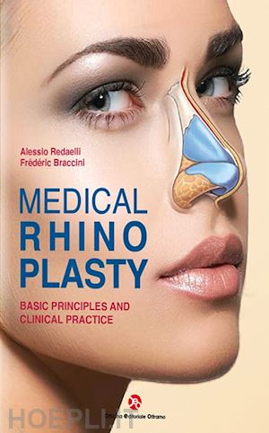 redaelli alessio; braccini frederic - medical rhinoplasty. basic principles and clinical practice